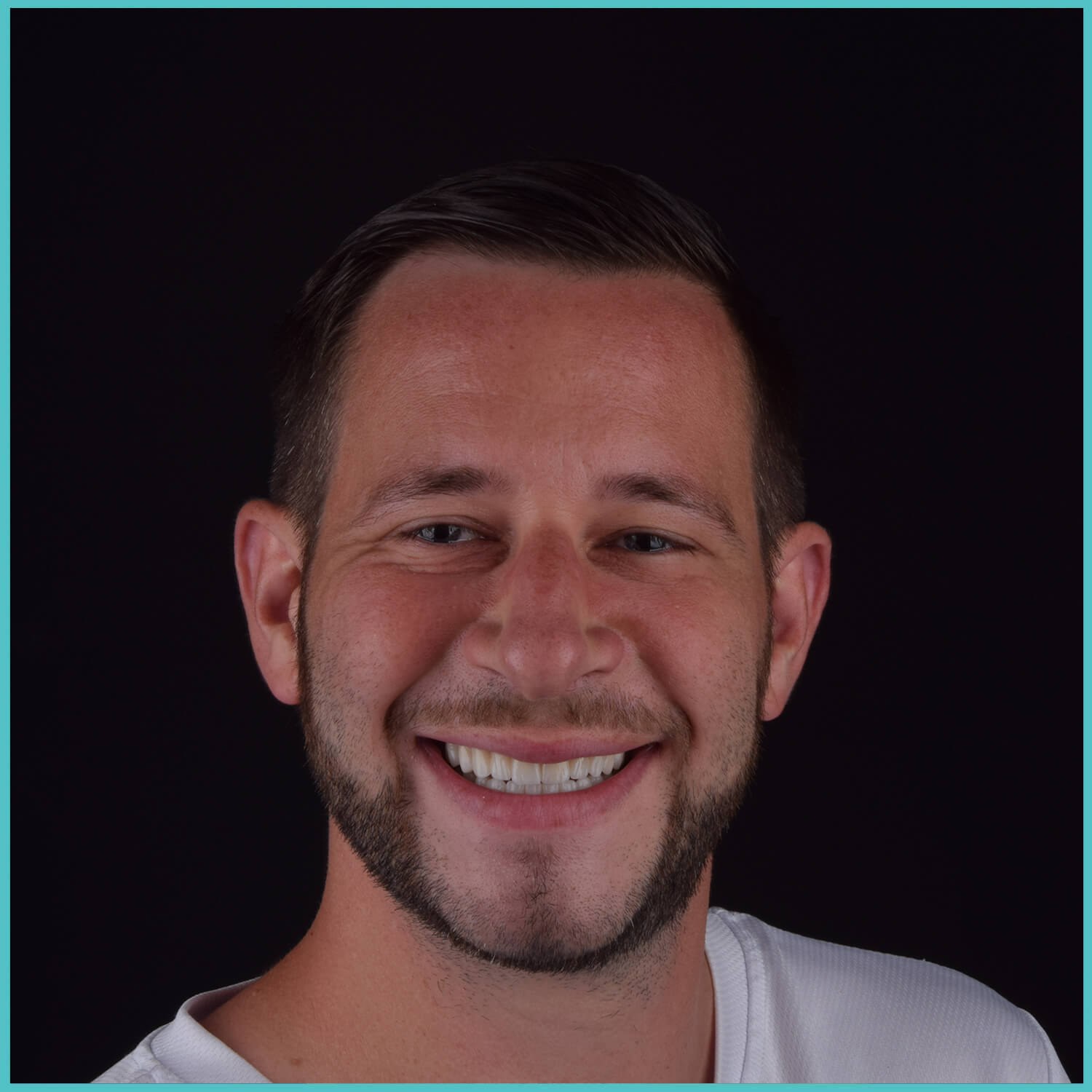 komplette zahnimplantate mit fly2smile