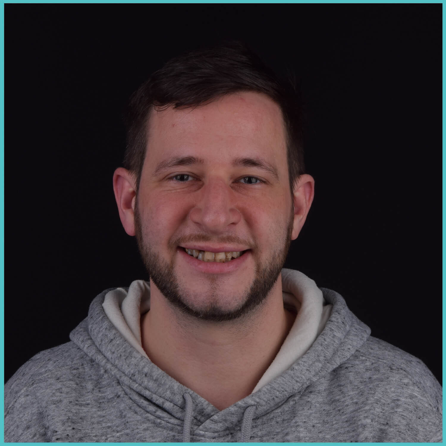 komplette zahnimplantate mit fly2smile