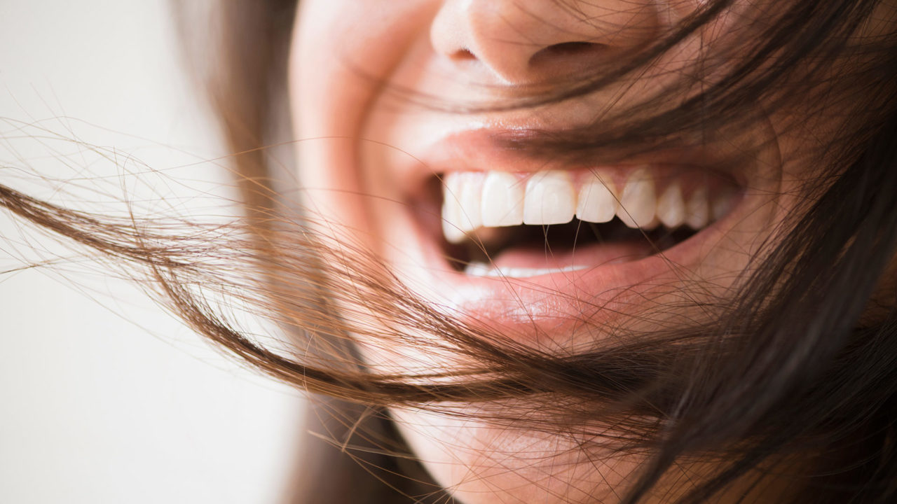 Zähne machen lassen Türkei Kosten Fly2Smile