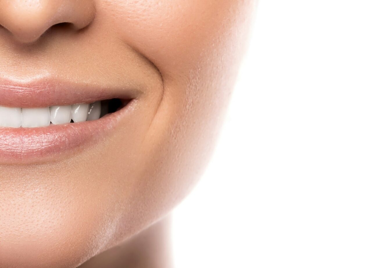 Weiße Diät Darauf sollte man nach einem Bleaching achten Fly2Smile
