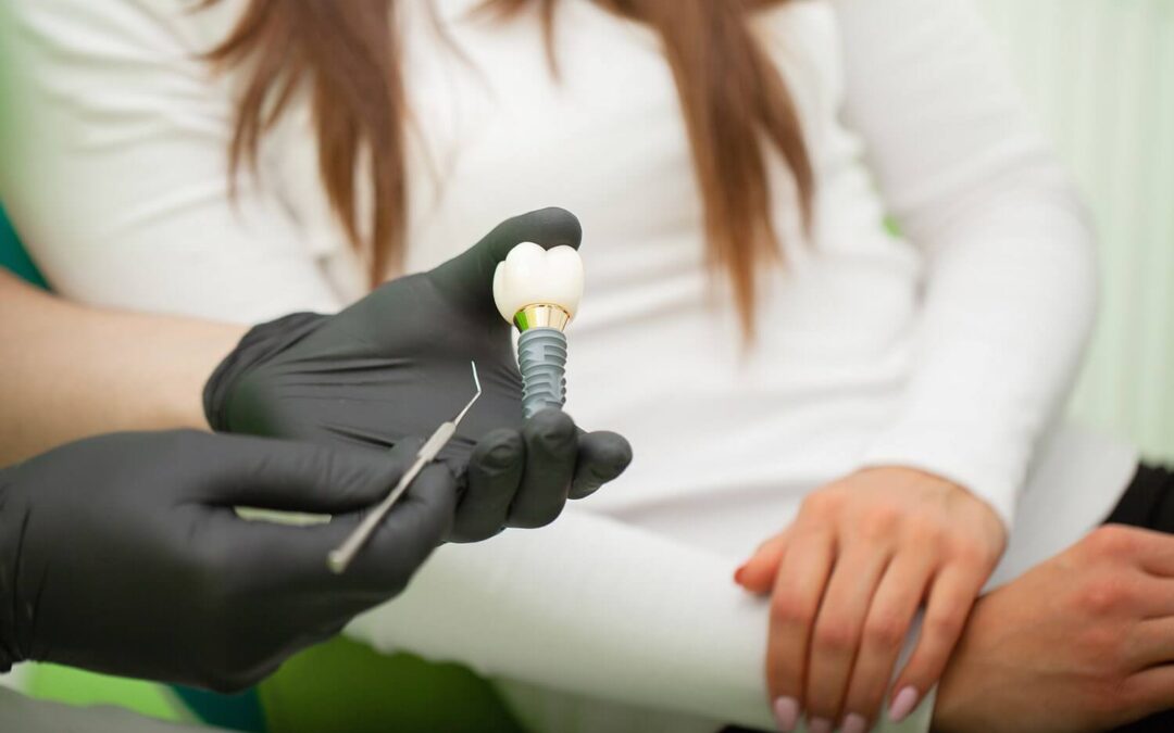 Reinigung Zahnimplantat – Tipps für gesunde Implantate