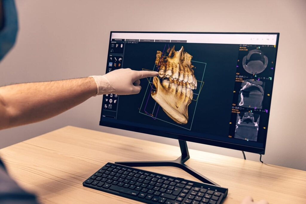 Digital Smile Design zur individuellen Planung eines ästhetischen und harmonischen Lächelns