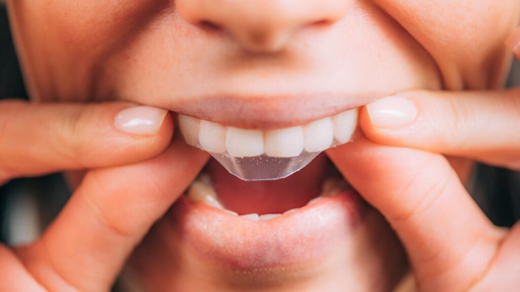 ALT-Text: Oral-B Whitening Strips für weißere Zähne und sichtbare Zahnaufhellung zu Hause