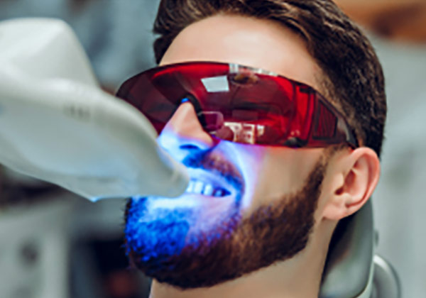 Preise für Bleaching in der Türkei im Vergleich für professionelle Zahnaufhellung und weiße Zähne
