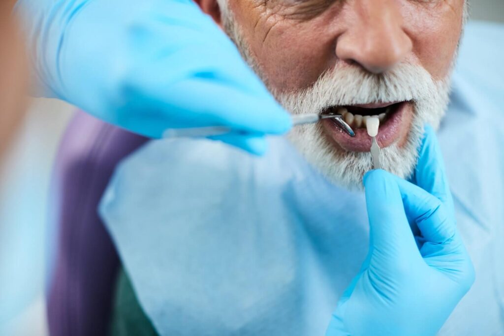 Veneers oder Kronen im Vergleich für ästhetischen und langlebigen Zahnersatz