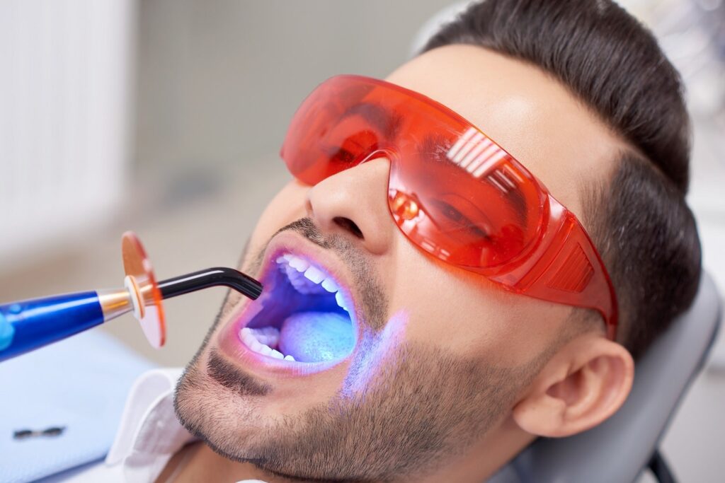 Bleaching zur Reduzierung weißer Flecken auf den Zähnen und für ein gleichmäßigeres Lächeln