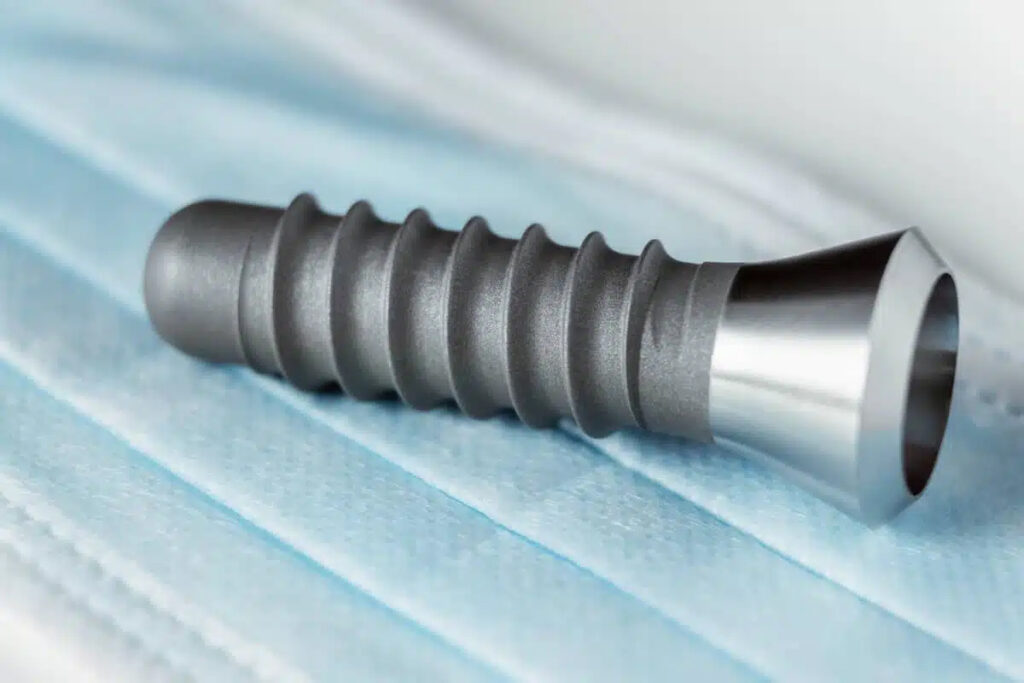 Camlog Implantat für langlebigen, stabilen und hochwertigen Zahnersatz