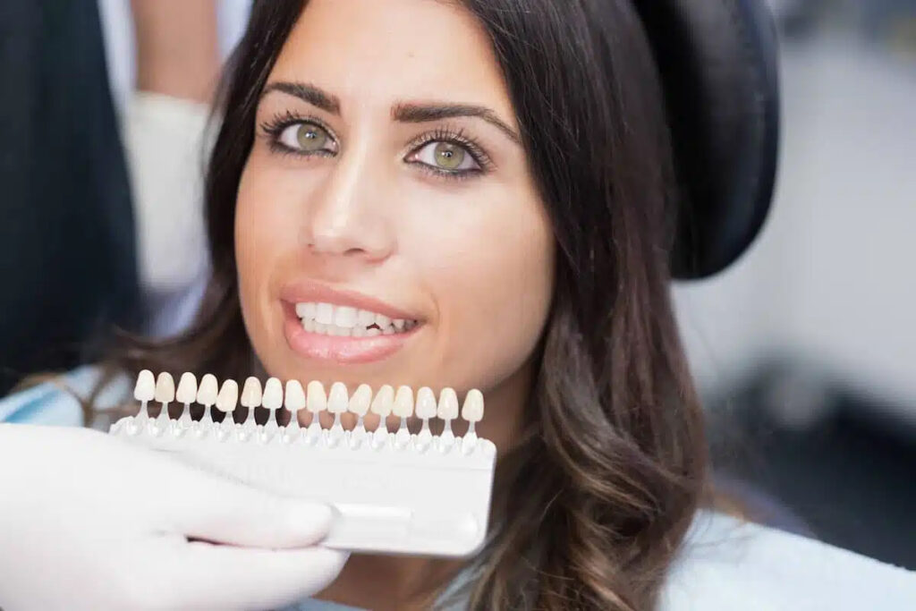 Konventionelle Veneers für ästhetische Zahnkorrekturen und ein natürliches Lächeln