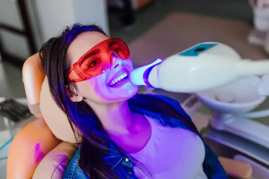 Wie lange hält Bleaching für dauerhaft weiße und strahlende Zähne