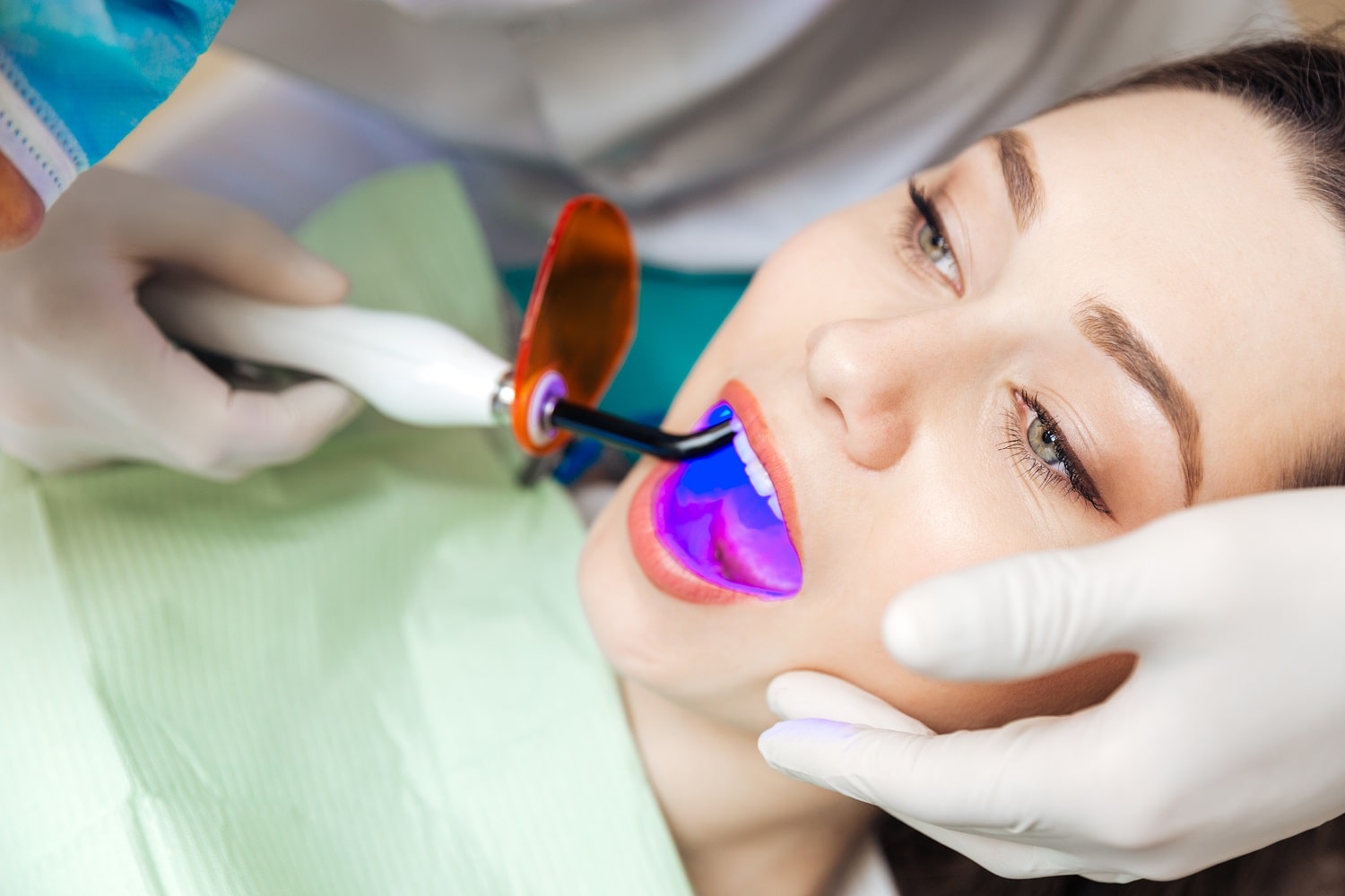 Bleaching in der Türkei für strahlend weiße und ästhetische Zähne