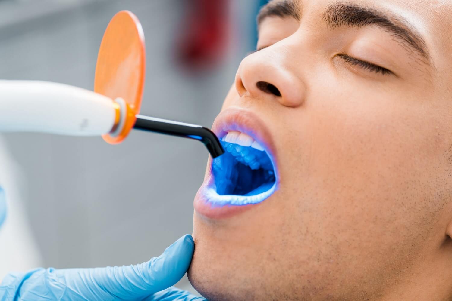 Bleaching für weiße Zähne und ein strahlendes, gepflegtes Lächeln