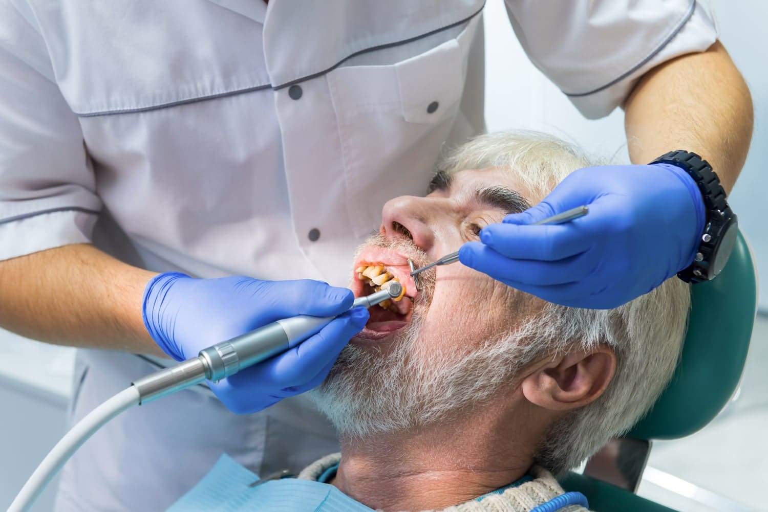 Behandlung von Zahnschäden durch Rauchen für gesündere und ästhetischere Zähne