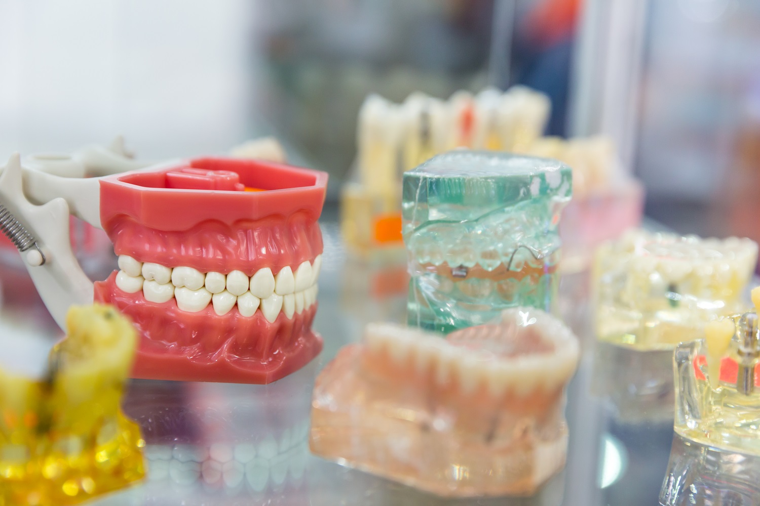 Zahnprothesen und Implantate für sicheren und ästhetischen Zahnersatz